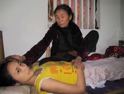 Thiếu nữ 8 năm chờ chết đã qua đời vì chảy máu tủy sống
