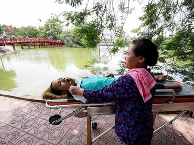 Nghị lực phi thường của chàng trai hiến đầu cho y học