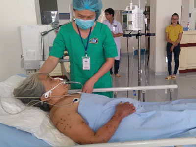 Bị ong vò vẽ đốt 200 mũi, cụ bà 79 tuổi nguy kịch