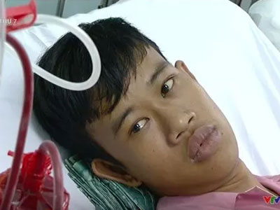 Tiết giảng bài đầu tiên đầy ý nghĩa của chàng trai 20 tuổi bị suy thận giai đoạn cuối