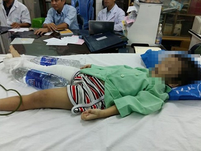 Cháu bé bị mẹ ruột và cha dượng "tung cước" gãy chân xuất viện