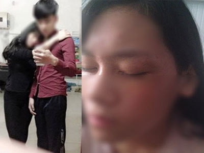 Nữ sinh Bắc Giang “tố” bị bạn trai chặn đánh sau chia tay