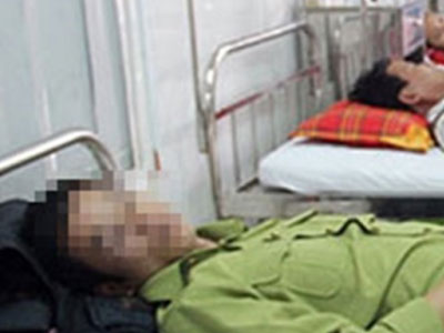 Cán bộ kiểm lâm bị đánh dập lá lách khi nhắc nhở ngư dân
