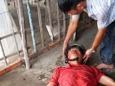 Ngã xe dưới mưa, người đàn ông nguy kịch