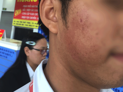 Bạn gái trễ giờ lên máy bay, nam thanh niên xông vào đánh nhân viên hàng không