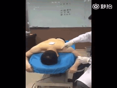 Màn châm cứu bằng "kim tiêm voi" khiến bất cứ ai cũng phải toát mồ hôi