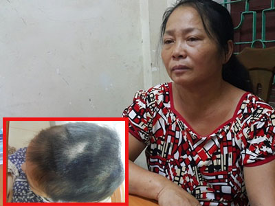 Trần tình của người phụ nữ cụt chân thuê giang hồ đánh ghen osin 19 tuổi cặp với chồng 62 tuổi
