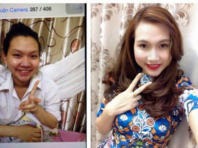 Bị nhà chồng chê xấu, mẹ một con đi phẫu thuật thẩm mỹ “lột xác” thành hot girl