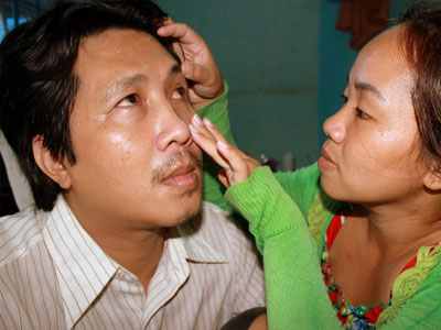 Vì yêu, người vợ nghèo cam tâm hiến mắt cho chồng mù, mong anh 1 lần được thấy mặt con