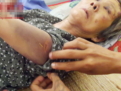 Vây bắt kẻ dùng gạch đập đầu cụ bà ăn xin cướp tiền