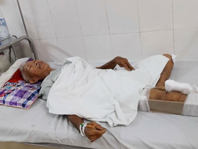 Vụ tài xế cán cụ ông gãy chân rồi bỏ chạy: "Tôi nằm nửa tiếng ngoài đường, chậm 10 phút là chết"