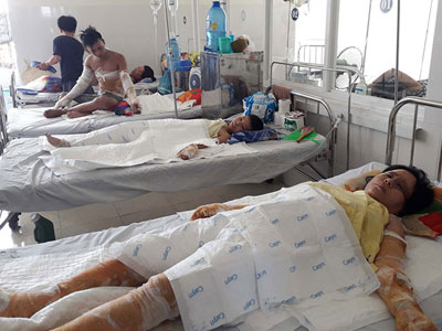 1 người chết, 4 người bị bỏng nặng vì đựng xăng trong túi ni lông