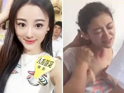 Giai nhân "Tây Thi" qua đời sau 2 tháng ung thư vì giác hơi