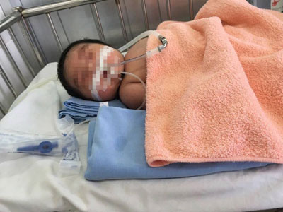 Bác sĩ trưởng khoa sản chậm ký giấy mổ, con sản phụ ra đời tím tái, suy hô hấp rồi tử vong?