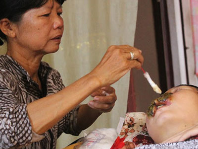 Cô gái bị bệnh lạ "ăn mặt": "Tôi muốn chết để gia đình bớt khổ"