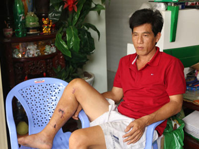 Vụ xe tải “dìu” xe khách mất phanh: Công an triệu tập chủ xe khách