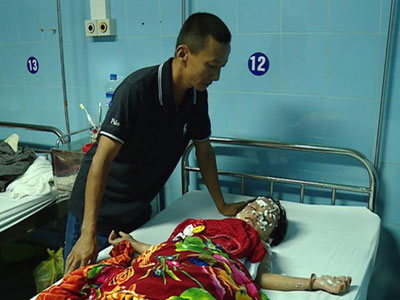 Nổ bóng bay Hidro trong đêm Trung thu, 9 người bị thương