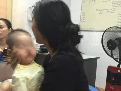 Lạ lùng bé 1 tuổi cứ cất tiếng khóc như tiếng mèo kêu