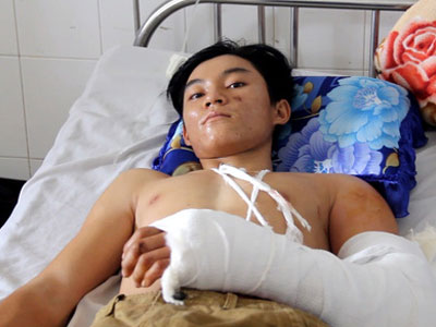 Nam thanh niên bị máy hút lúa “nuốt” cánh tay
