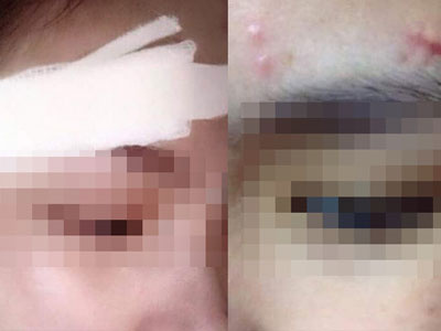 Chàng trai đối xử tàn tệ, đá rách mặt bạn gái cũ