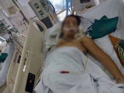 Cô giáo trẻ bị xe chèn ngang người được mổ cứu con