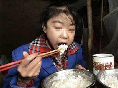 Kỳ lạ bé gái 15 tuổi mỗi ngày ăn 7kg gạo nhưng không mập lên nổi