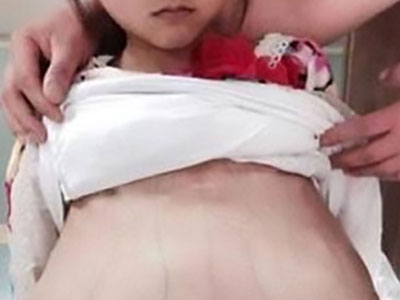 Người đàn ông 40 tuổi đưa bé gái mới 12 tuổi mang bầu to vượt mặt đi khám thai