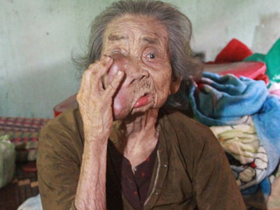Gặp cụ bà 92 tuổi có "khuôn mặt quỷ"