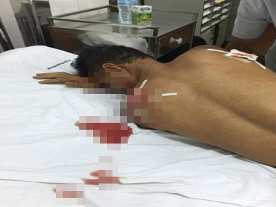 Đâm chém hàng xóm trọng thương vì bị nhắc nhở