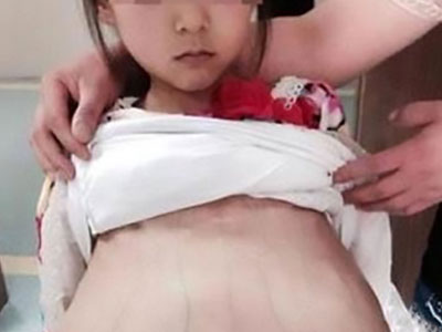 Bé gái Việt 12 tuổi mang thai 3 tháng bị bán làm vợ với giá hơn 100 triệu