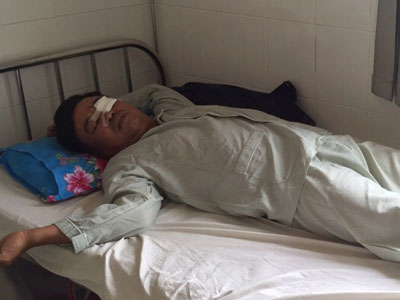 Bị đánh hỏng mắt vì nói “em đưa mic cho anh hát bài”