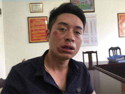 Ảnh bìa bài viết 399827