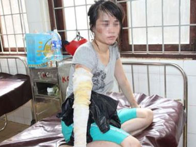 Đổ nước sôi lên đầu vợ vì làm đẹp: Cuộc sống địa ngục trần gian gần 10 năm ròng của người vợ