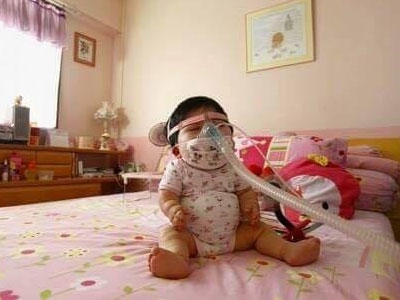 Làm sao bạn có thể tin rằng đứa bé sơ sinh này thực ra đã... 17 tuổi?