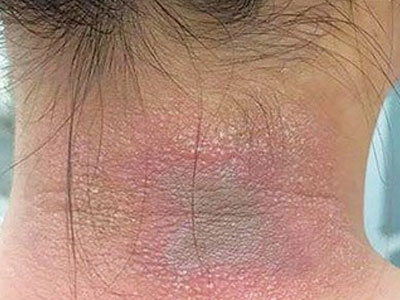 Kiến ba khoang tấn công nhà dân ở Hà Nội