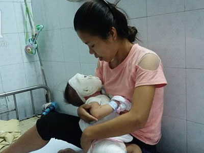 Mẹ sơ sẩy, con trai 11 tháng tuổi bị ấm nước siêu tốc đổ xuống đầu, bỏng nặng toàn thân