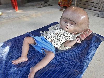Cô bé "người ngoài hành tinh" được tìm thấy trong ngôi làng nghèo khó