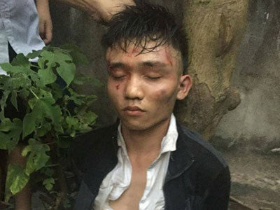 Táo tợn xông vào nhà giật túi xách, cứa cổ bà chủ tiệm tạp hóa ở Hà Nội
