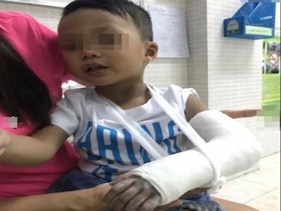 Phẫn nộ giáo viên mầm non đập bàn "vô tình" làm gãy tay bé trai 3 tuổi