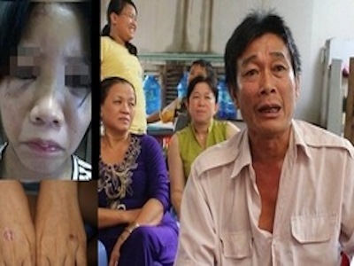 Nữ sinh run sợ kể phút bị bạn châm thuốc lá vào tay, bắt liếm chân