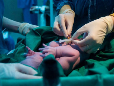 Bác sĩ mổ đẻ làm gãy chân bé sơ sinh