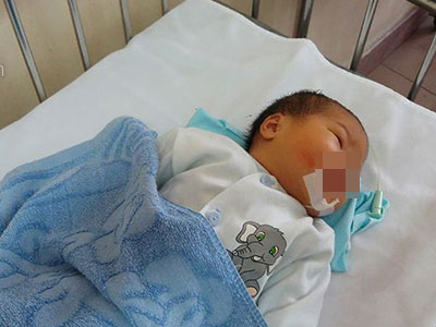 Hà Nội: Sản phụ bỏ rơi con gái 6 ngày tuổi tại bệnh viện khi biết con bị hở hàm ếch