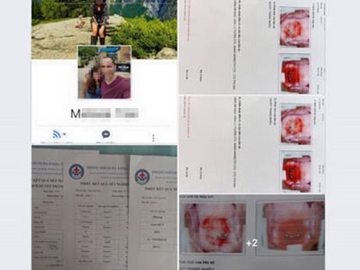 Hồ sơ bệnh án bị tung lên Facebook