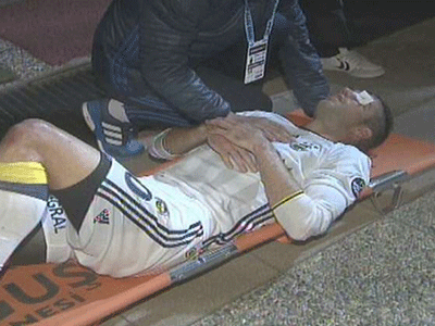 Van Persie suýt mù mắt do chấn thương