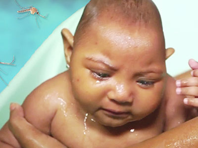 Sắp thử nghiệm thuốc điều trị Zika trên người