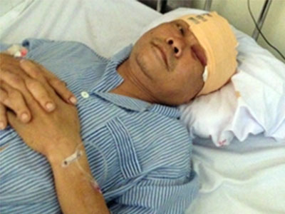 Côn đồ chém trọng thương trung tá công an