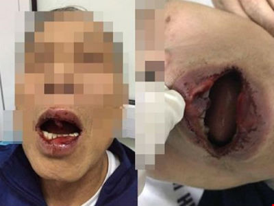 Công an vào cuộc vụ công chức đánh tiến sĩ 76 tuổi