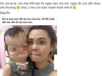 Ảnh mẹ trẻ và con tật nguyền: Tình mẫu tử thiêng liêng