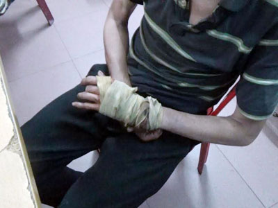 Người đàn ông giả tàn tật xin tiền du khách ở Sài Gòn