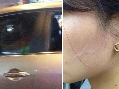 Đại gia dừng ô tô, tát vào mặt thiếu nữ?
